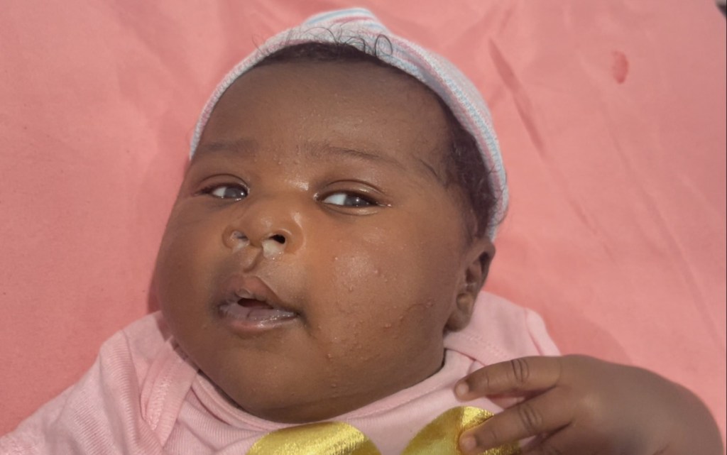 How I Eased My Baby Cold&nbsp;Naturally